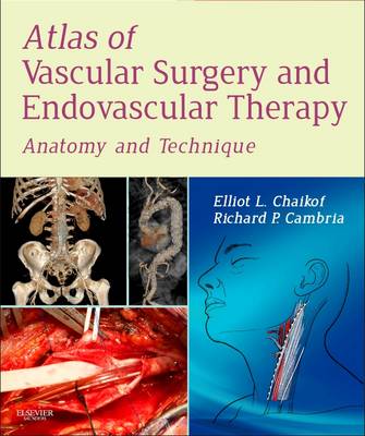 Atlas of Vascular Surgery and Endovascular Therapy E-Book: Atlas of Vascular Surgery and Endovascular Therapy E-Book