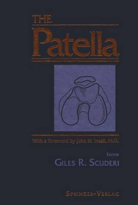 Patella