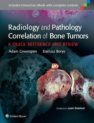 Radiology and Pathology Correlation of Bone Tumors: A Quick Reference and Review First, None