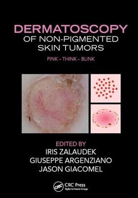 Dermatoscopy of Non-Pigmented Skin Tumors: Pink - Think - Blink
