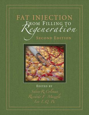 Fat Injection: From Filling to Regeneration 2nd Revised edition