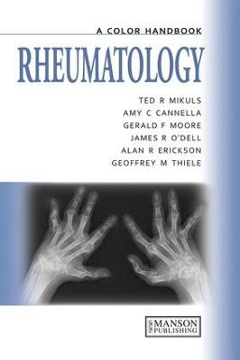 Rheumatology: A Color Handbook