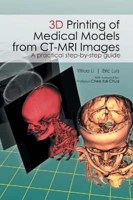 3D Printing of Medical Models  from Ct-Mri Images: A Practical Step-By-Step Guide