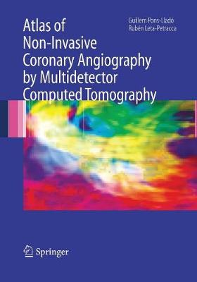 Atlas of Non-Invasive Coronary Angiography by Multidetector Computed  Tomography Softcover reprint of the original 1st ed. 2006