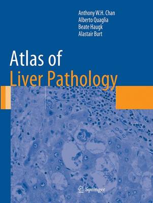 Atlas of Liver Pathology Softcover reprint of the original 1st ed. 2014