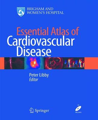 Essential Atlas of Cardiovascular Disease Softcover reprint of the original 4th ed. 2009