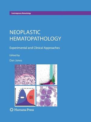 Neoplastic Hematopathology: Experimental and Clinical Approaches Softcover reprint of the original 1st ed. 2010