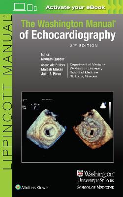 Washington Manual of Echocardiography 2nd edition