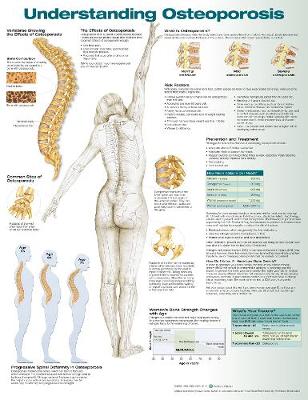 Understanding Osteoporosis Anatomical Chart 3rd edition