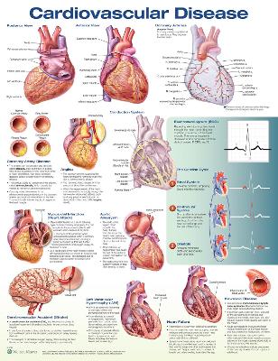 Cardiovascular Disease Anatomical Chart 3rd edition
