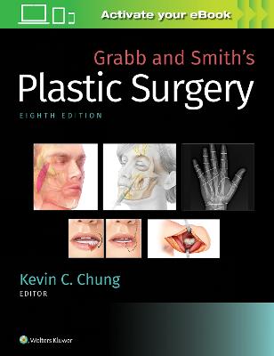 Grabb and Smith's Plastic Surgery