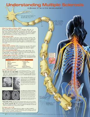 Understanding Multiple Sclerosis Anatomical Chart 2nd edition