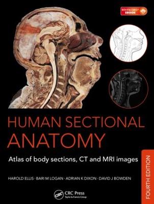 Human Sectional Anatomy: Atlas of Body Sections, CT and MRI Images, Fourth Edition 4th edition