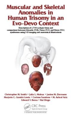 Muscular and Skeletal Anomalies in Human Trisomy in an Evo-Devo Context: Description of a T18 Cyclopic Fetus and Comparison Between Edwards (T18),  Patau (T13) and Down (T21) Syndromes Using 3-D Imaging and Anatomical Illustrations