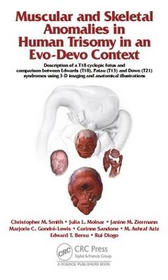Muscular and Skeletal Anomalies in Human Trisomy in an Evo-Devo Context: Description of a T18 Cyclopic Fetus and Comparison Between Edwards (T18), Patau (T13) and Down (T21) Syndromes Using 3-D Imaging and Anatomical Illustrations