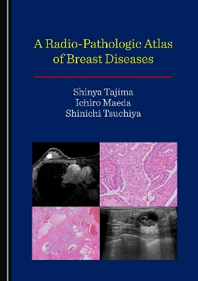 Radio-Pathologic Atlas of Breast Diseases