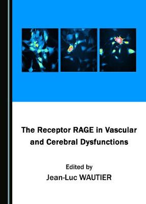 Receptor RAGE in Vascular and Cerebral Dysfunctions