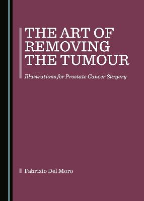 Art of Removing the Tumour: Illustrations for Prostate Cancer Surgery Unabridged edition