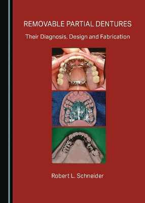 Removable Partial Dentures: Their Diagnosis, Design and Fabrication Unabridged edition