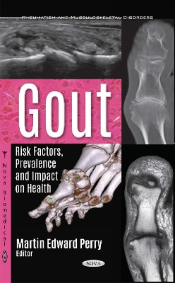 Gout: Risk Factors, Prevalence and Impact on Health