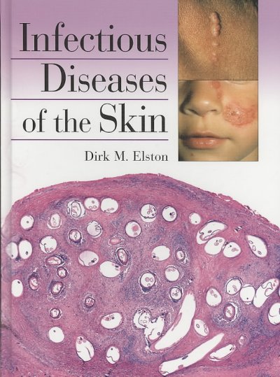 Infectious Diseases of the Skin
