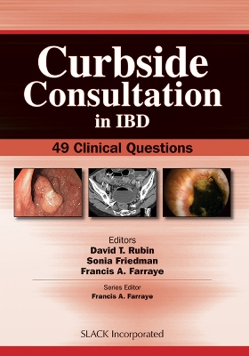 Curbside Consultation in IBD: 49 Clinical Questions