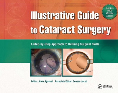 Illustrative Guide to Cataract Surgery: A Step-by-Step Approach to Refining Surgical Skills
