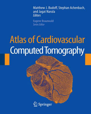 Atlas of Cardiovascular Computed Tomography 2007 ed.