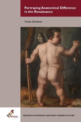 Portraits of Human Monsters in the Renaissance: Dwarves, Hirsutes, and Castrati as Idealized Anatomical Anomalies