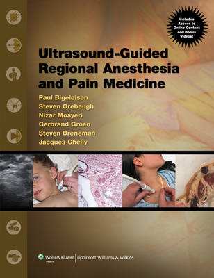 Ultrasound Guided Regional Anesthesia and Pain Medicine: Techniques and Tips
