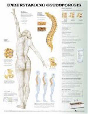 Understanding Osteoporosis
