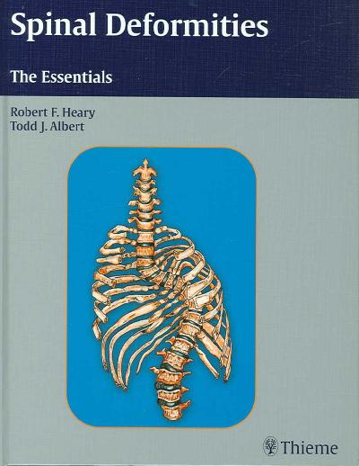 Spinal Deformities: The Essentials