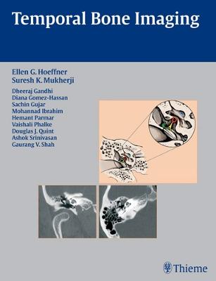 Temporal Bone Imaging New edition