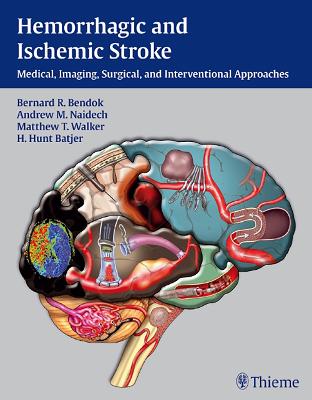 Hemorrhagic and Ischemic Stroke: Medical, Imaging, Surgical and Interventional Approaches New edition