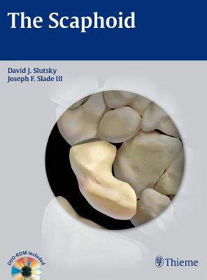 Scaphoid