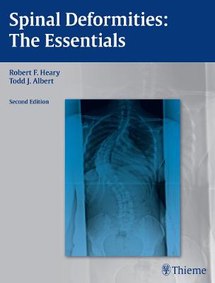 Spinal Deformities: The Essentials 2nd New edition