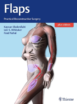 Flaps: Practical Reconstructive Surgery New edition