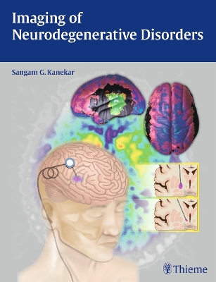 Imaging of Neurodegenerative Disorders New edition
