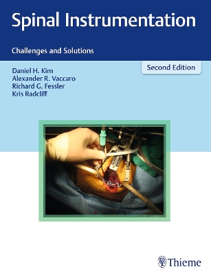 Spinal Instrumentation: Challenges and Solutions 2nd New edition