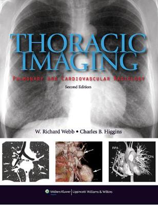 Thoracic Imaging: Pulmonary and Cardiovascular Radiology Second, North American Edition