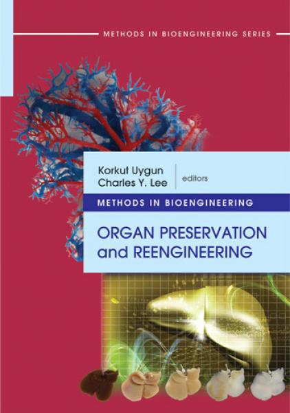 Methods in Bioengineering: Organ Preservation and Reengineering