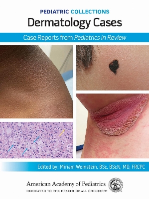 Dermatology Cases: Case Reports from Pediatrics in Review