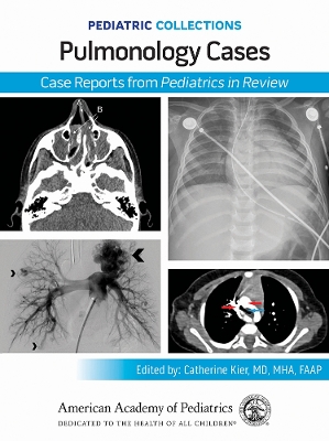 Pulmonology Cases: Case Reports from Pediatrics in Review