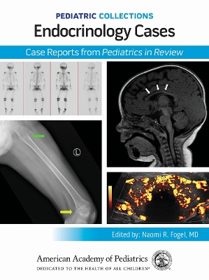 Endocrinology Cases: Case Reports from Pediatrics in Review