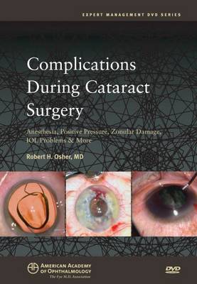 Complications During Cataract Surgery: Anesthesia, Positive Pressure, Zonular Damage, Iol Problems and More