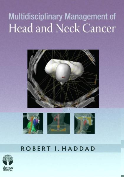 Multidisciplinary Management of Head and Neck Cancer
