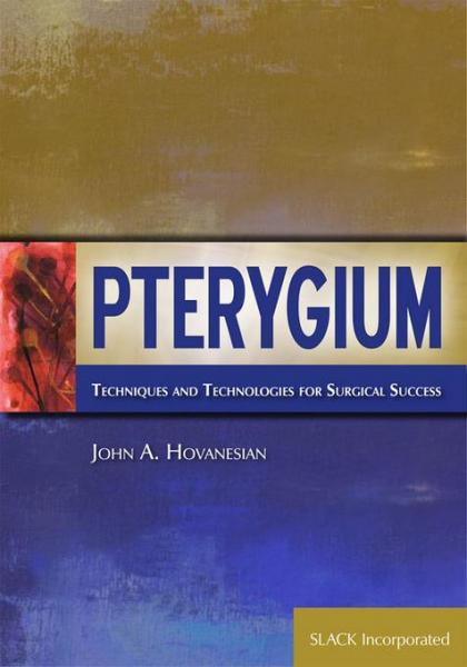 Pterygium: Techniques and Technologies for Surgical Success