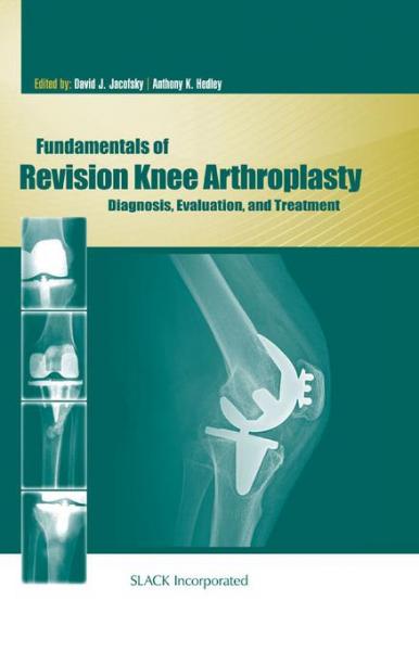 Fundamentals of Revision Knee Arthroplasty: Diagnosis, Evaluation, and Treatment