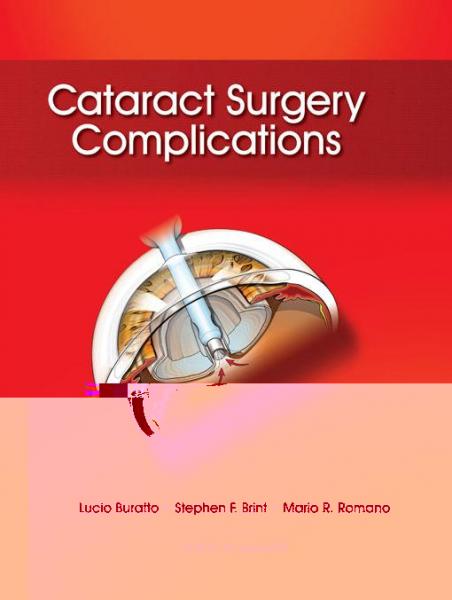 Cataract Surgery Complications