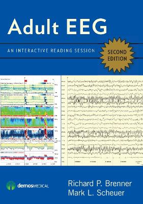 Adult EEG: An Interactive Reading Session 2nd Revised edition